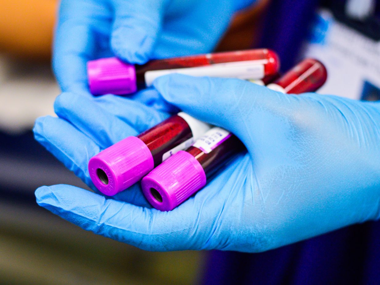 Secondary breast cancer